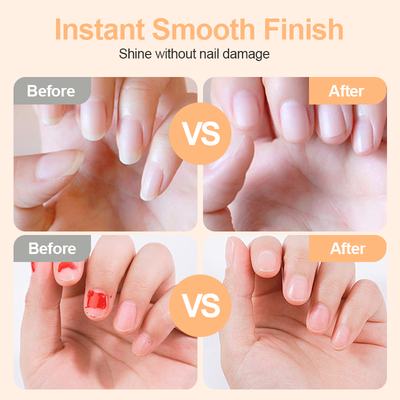 ⏳Time-Limited Special⏰2-in-1 Smart Electric Nail Trimmer & Polisher for All Ages 👨👩👧👦 – Blade-Free, Blood-Free & Stress-Free Nail Care! 💅